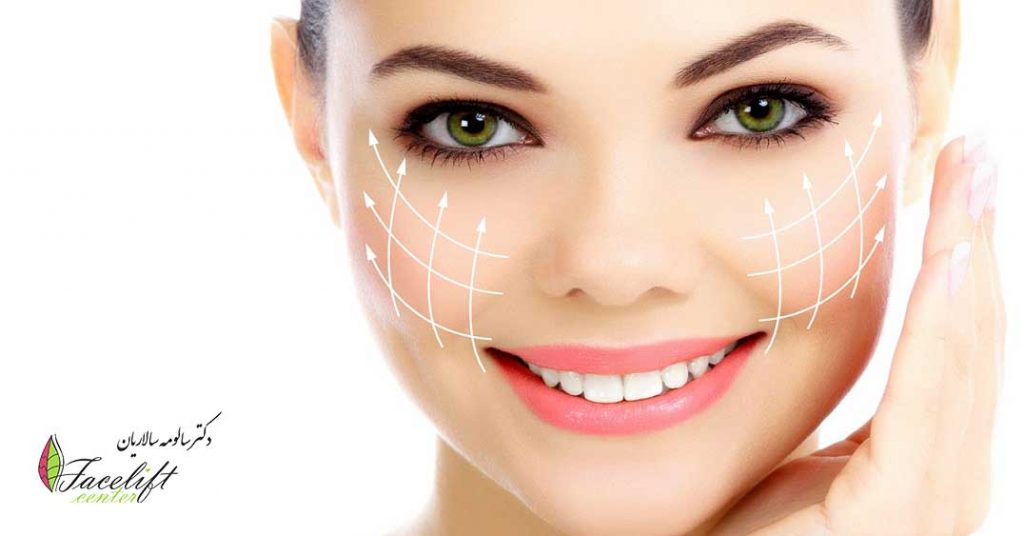 face lift before and after photos